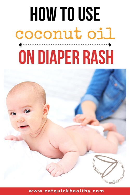 How To Use Coconut Oil For Diaper Rash