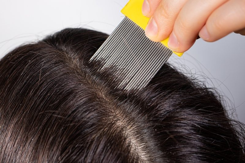 Using Coconut Oil For Lice: Results And How To Use It - Eat Quick Healthy