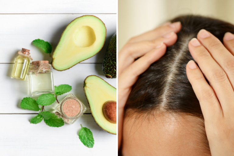 avocado oil for scalp