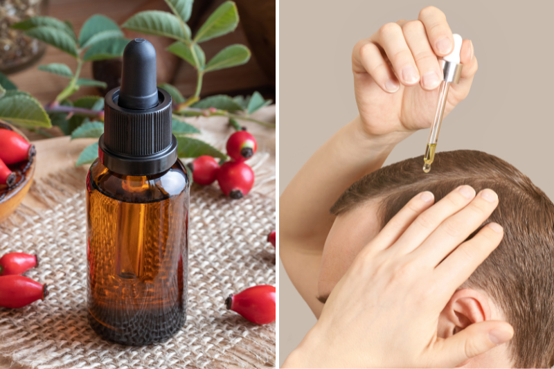 rosehip oil for scalp